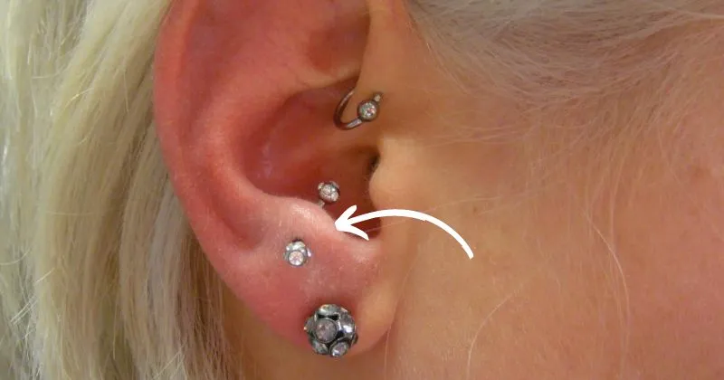 Anti-Tragus Piercing